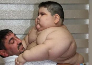 4 yaşında bu kiloya ulaştı!