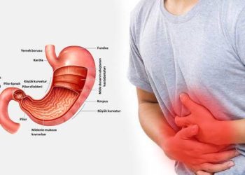 Mide ağrısına ne iyi gelir? Gece mide ağrısını geçirmek için doğal tedaviler