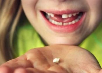 Rüyada diş dökülmesi ne anlama gelir? Rüyada diş düşmesi tabiri