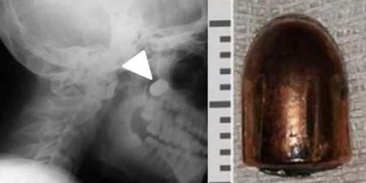 Ukraynalı çocuğun mucize kurtuluşu