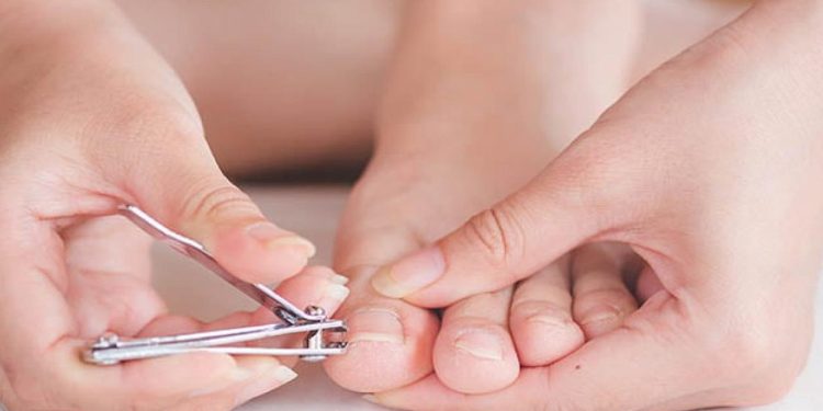 Ayak tırnak batması nasıl geçer? Geçmeyen tırnak batması neden olur?